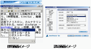 アドバンストメディア 医療機関向け音声入力システム「AmiVoice Ex」 シリーズ新バージョンを販売開始